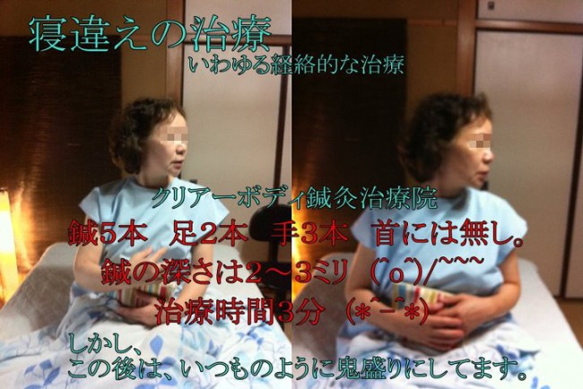 寝違えの治療2012年6月